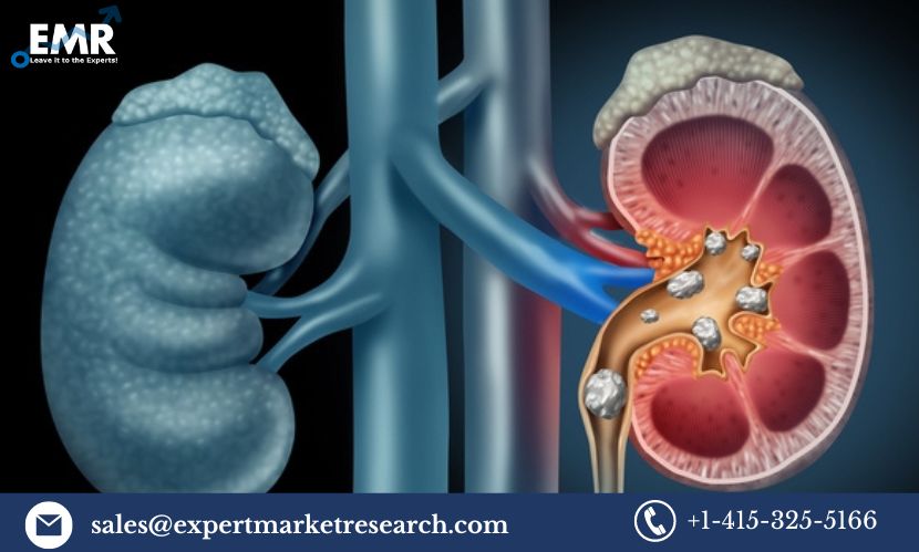 Global Primary Hyperoxaluria Treatment Market Size To Grow At A CAGR Of 3.7% In The Forecast Period Of 2023-2031