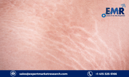 Stretch Marks Treatment Market Price, Trends, Size, Share, Growth, Analysis, Report, Forecast 2023-2028